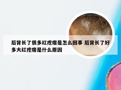 后背长了很多红疙瘩是怎么回事 后背长了好多大红疙瘩是什么原因