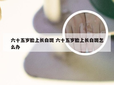 六十五岁脸上长白斑 六十五岁脸上长白斑怎么办