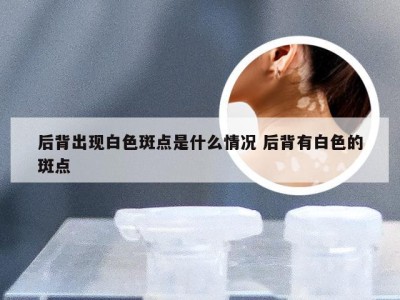 后背出现白色斑点是什么情况 后背有白色的斑点