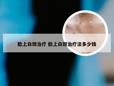 脸上白斑治疗 脸上白斑治疗法多少钱