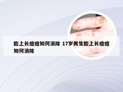 脸上长痘痘如何消除 17岁男生脸上长痘痘如何消除