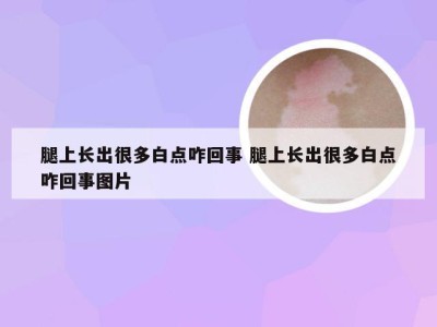 腿上长出很多白点咋回事 腿上长出很多白点咋回事图片