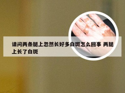 请问两条腿上忽然长好多白斑怎么回事 两腿上长了白斑