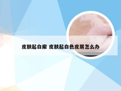 皮肤起白廨 皮肤起白色皮屑怎么办