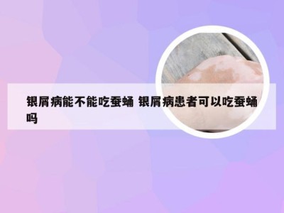 银屑病能不能吃蚕蛹 银屑病患者可以吃蚕蛹吗