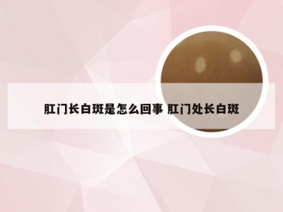 肛门长白斑是怎么回事 肛门处长白斑