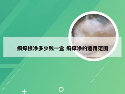 癣痒根净多少钱一盒 癣痒净的适用范围