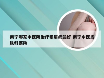 南宁哪家中医院治疗银屑病最好 南宁中医皮肤科医院