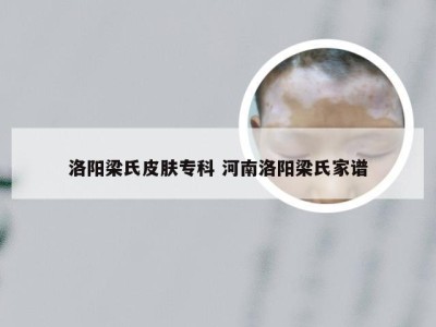 洛阳梁氏皮肤专科 河南洛阳梁氏家谱