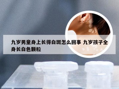 九岁男童身上长得白斑怎么回事 九岁孩子全身长白色颗粒