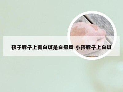 孩子脖子上有白斑是白癜风 小孩脖子上白斑