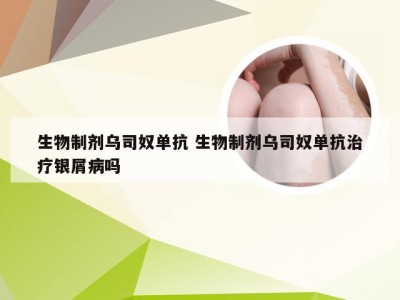 生物制剂乌司奴单抗 生物制剂乌司奴单抗治疗银屑病吗