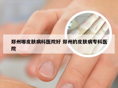 郑州哪皮肤病科医院好 郑州的皮肤病专科医院