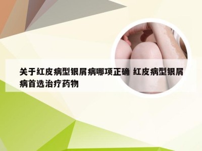 关于红皮病型银屑病哪项正确 红皮病型银屑病首选治疗药物