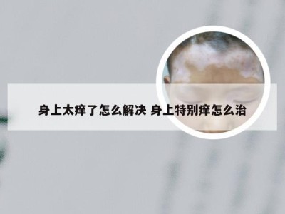 身上太痒了怎么解决 身上特别痒怎么治