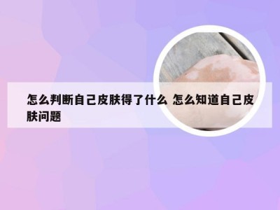 怎么判断自己皮肤得了什么 怎么知道自己皮肤问题