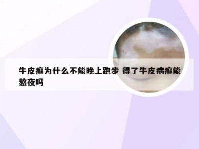 牛皮癣为什么不能晚上跑步 得了牛皮病癣能熬夜吗