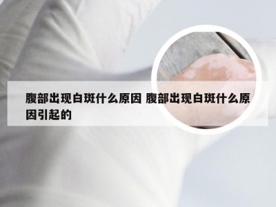 腹部出现白斑什么原因 腹部出现白斑什么原因引起的