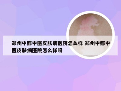 郑州中都中医皮肤病医院怎么样 郑州中都中医皮肤病医院怎么样呀