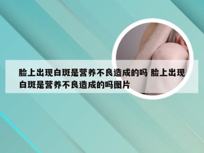 脸上出现白斑是营养不良造成的吗 脸上出现白斑是营养不良造成的吗图片