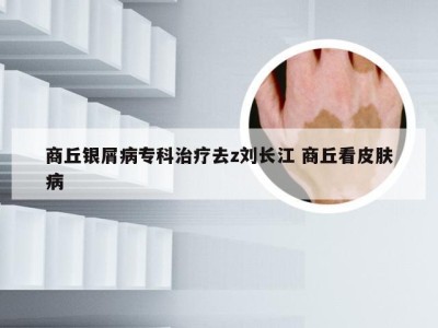 商丘银屑病专科治疗去z刘长江 商丘看皮肤病