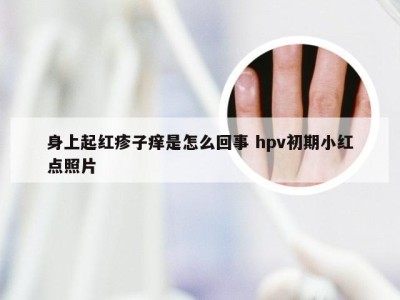 身上起红疹子痒是怎么回事 hpv初期小红点照片