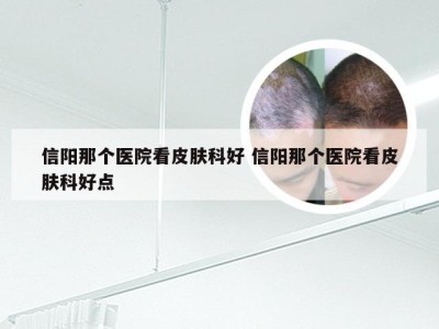 信阳那个医院看皮肤科好 信阳那个医院看皮肤科好点