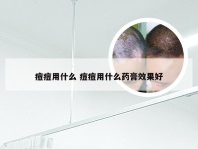 痘痘用什么 痘痘用什么药膏效果好