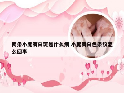 两条小腿有白斑是什么病 小腿有白色条纹怎么回事