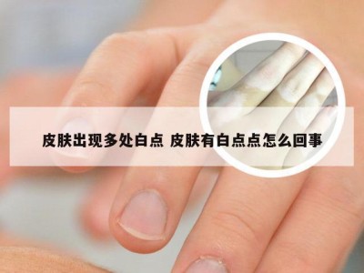 皮肤出现多处白点 皮肤有白点点怎么回事