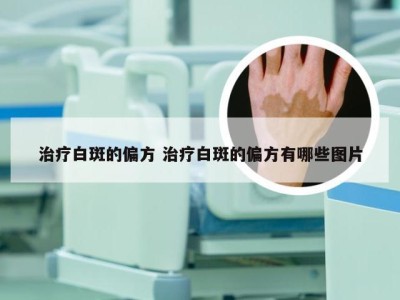 治疗白斑的偏方 治疗白斑的偏方有哪些图片