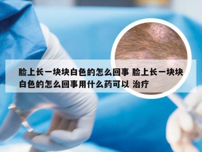 脸上长一块块白色的怎么回事 脸上长一块块白色的怎么回事用什么药可以 治疗