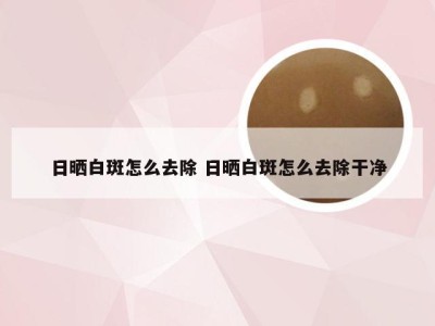 日晒白斑怎么去除 日晒白斑怎么去除干净