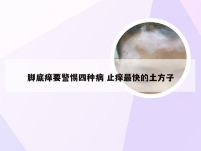 脚底痒要警惕四种病 止痒最快的土方子