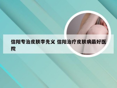 信阳专治皮肤李先义 信阳治疗皮肤病最好医院