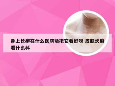 身上长癣在什么医院能把它看好呀 皮肤长癣看什么科