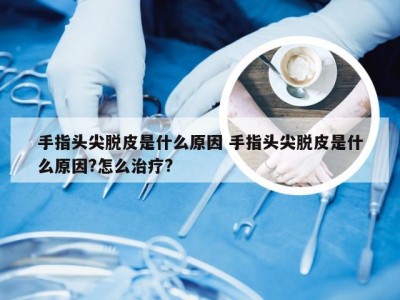 手指头尖脱皮是什么原因 手指头尖脱皮是什么原因?怎么治疗?