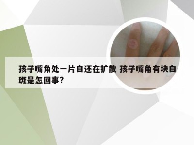 孩子嘴角处一片白还在扩散 孩子嘴角有块白斑是怎回事?