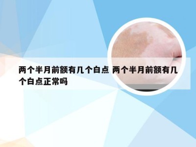 两个半月前额有几个白点 两个半月前额有几个白点正常吗