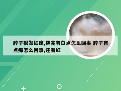 脖子根发红痒,挠完有白点怎么回事 脖子有点痒怎么回事,还有红