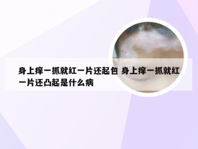 身上痒一抓就红一片还起包 身上痒一抓就红一片还凸起是什么病