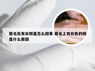 眉毛处有白斑是怎么回事 眉毛上有白色的斑是什么原因