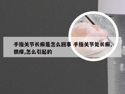 手指关节长癣是怎么回事 手指关节处长癣,很痒,怎么引起的