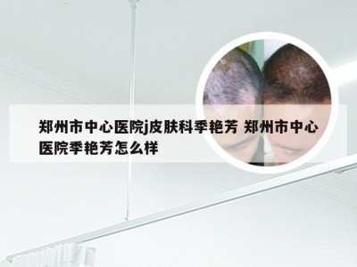 郑州市中心医院j皮肤科季艳芳 郑州市中心医院季艳芳怎么样