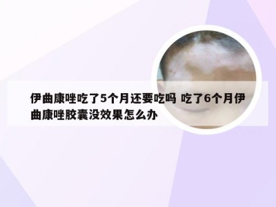 伊曲康唑吃了5个月还要吃吗 吃了6个月伊曲康唑胶囊没效果怎么办