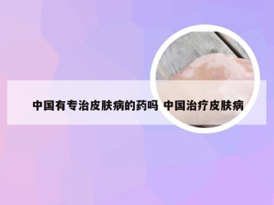 中国有专治皮肤病的药吗 中国治疗皮肤病