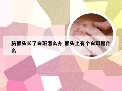 脑额头长了白班怎么办 额头上有个白斑是什么