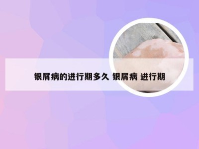 银屑病的进行期多久 银屑病 进行期