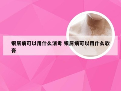 银屑病可以用什么消毒 银屑病可以用什么软膏