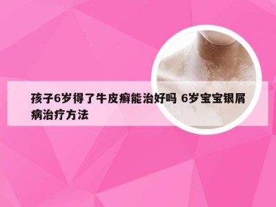 孩子6岁得了牛皮癣能治好吗 6岁宝宝银屑病治疗方法